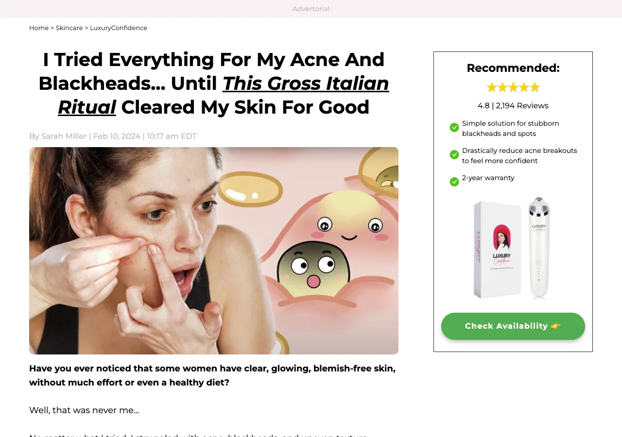 The LuxuryConfidence advertorial 'I Tried Everything For My Acne And Blackheads… Until This Gross Italian Ritual Cleared My Skin For Good', a first-person diary narrated by Sarah Miller